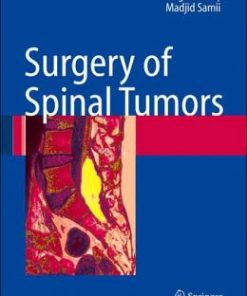 Surgery of Spinal Tumors (PDF)