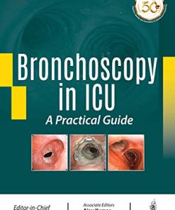 Bronchoscopy in ICU: A Practical Guide (Converted PDF)