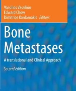 Bone Metastases: A translational and Clinical Approach (PDF)