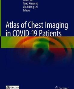 Atlas of Chest Imaging in COVID-19 Patients (PDF)