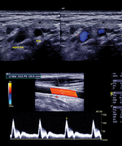 Clinical Approach to Vascular Ultrasound and RPVI Prep Course 2021 (CME VIDEOS)