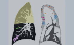 MRIOnline Imaging Mastery Series: Consolidation and Ground Glass 2021 (CME VIDEOS)