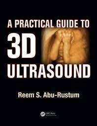 A Practical Guide to 3D Ultrasound