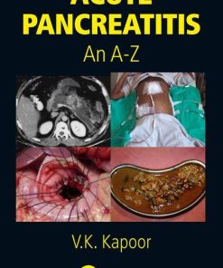 Acute Pancreatitis: An A-Z 1st