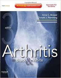 Arthritis in Black and White: Expert Consult – Online and Print, 3e