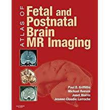 Atlas of Fetal and Infant Brain MR