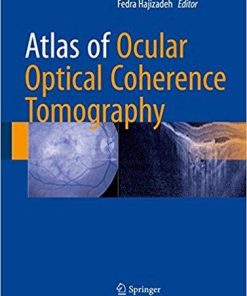 Atlas of Ocular Optical Coherence Tomography 1st ed. 2018