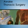 Awake Thoracic Surgery