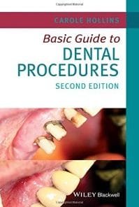 Basic Guide to Dental Procedures, 2nd Edition