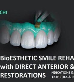 BioEsthetic Smile Rehabilitations with Direct Anterior & Posterior Restorations