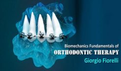 Biomechanics Fundamentals of Orthodontic Therapy