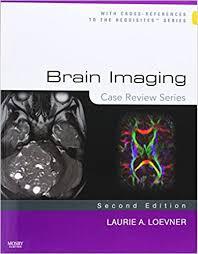 Brain Imaging: Case Review Series, 2nd Edition