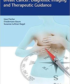 Breast Cancer: Diagnostic Imaging and Therapeutic Guidance 1st