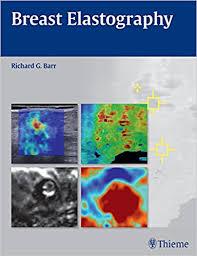 Breast Elastography Kindle Edition