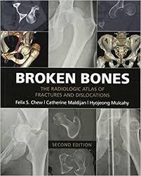 Broken Bones : The Radiologic Atlas of Fractures and Dislocations, 2nd Edition