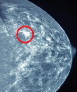 UCSF Breast Imaging 2022 (CME VIDEOS)