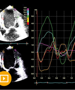 Echocardiography – A Comprehensive Review 2022 (CME VIDEOS)