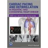 Cardiac Pacing and Defibrillation in Pediatric and Congenital Heart Disease 1st Edition