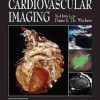 Cardiovascular Imaging