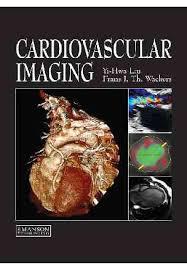 Cardiovascular Imaging