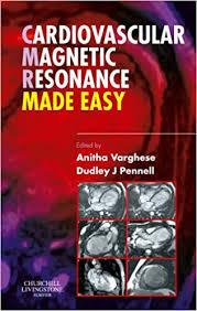 Cardiovascular Magnetic Resonance Made Easy, 1e