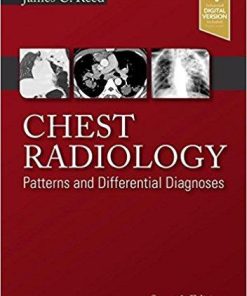 Chest Radiology: Patterns and Differential Diagnoses, 7e 7th Edition