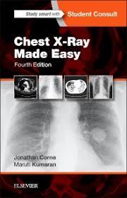 Chest X-Ray Made Easy, 4e