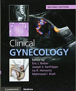 Clinical Gynecology 2nd Edition