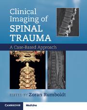 Clinical Imaging of Spinal Trauma: A Case-Based Approach