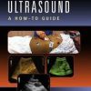 Clinical Ultrasound: A How-To Guide