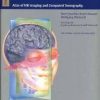 Cranial Neuroimaging and Clinical Neuroanatomy: Magnetic Resonance Imaging and Computed Tomography