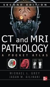 CT & MRI Pathology: A Pocket Atlas, Second Edition 2nd Edition