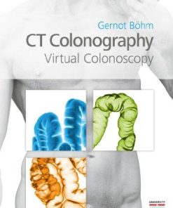 CT Colonography, Virtual Colonoscopy