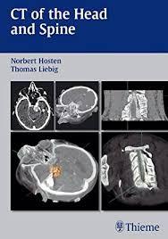 CT of the Head and Spine