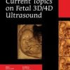 Current Topics on Fetal 3D/4D Ultrasound