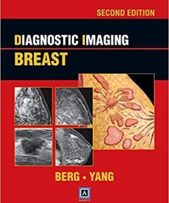 Diagnostic Imaging: Breast, 2nd ed: Published by Amirsys Second Edition