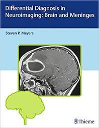 Differential Diagnosis in Neuroimaging: Brain and Meninges 1st Edition