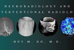 Neuroradiology and Interventional Radiology 2020 (CME VIDEOS)