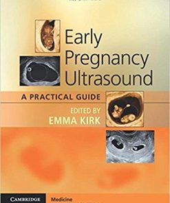 Early Pregnancy Ultrasound: A Practical Guide 1st