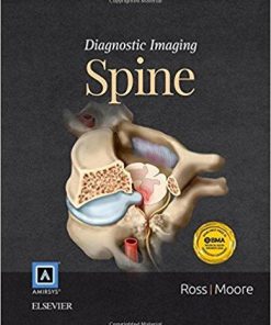 Ebook Diagnostic Imaging: Spine, 3e