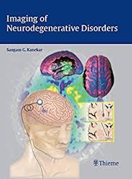 Ebook maging of Neurodegenerative Disorders