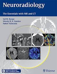 Ebook Neuroradiology: The Essentials with MR and CT