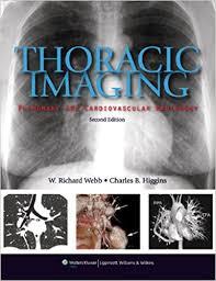 Ebook Thoracic Imaging: Pulmonary and Cardiovascular Radiology, 2nd Edition