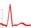 ECGAcademy: Basic to Advanced Theory + Chalktalk Videos (up to December 2016)