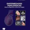 Enfermedades pericárdicas: Atlas de diagnóstico clínico por imagen