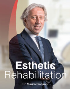 Esthetic Rehabilitation Esthetic and Functional 236x300 1