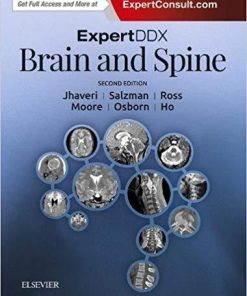 ExpertDDx: Brain and Spine 2nd Edition