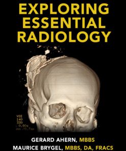 Exploring Essential Radiology (Videos)