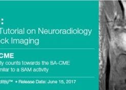 Atlas & Som: A Case-by-Case Tutorial On Neuroradiology and Head and Neck Imaging 2017 (CME Videos)