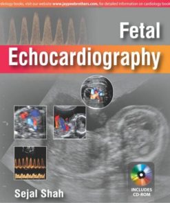 Fetal Echocardiography-Original PDF